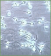 articles/sperms.gif articles/sperms.gif